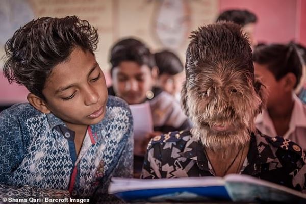 13-летнего индийского мальчика называют настоящим оборотнем 